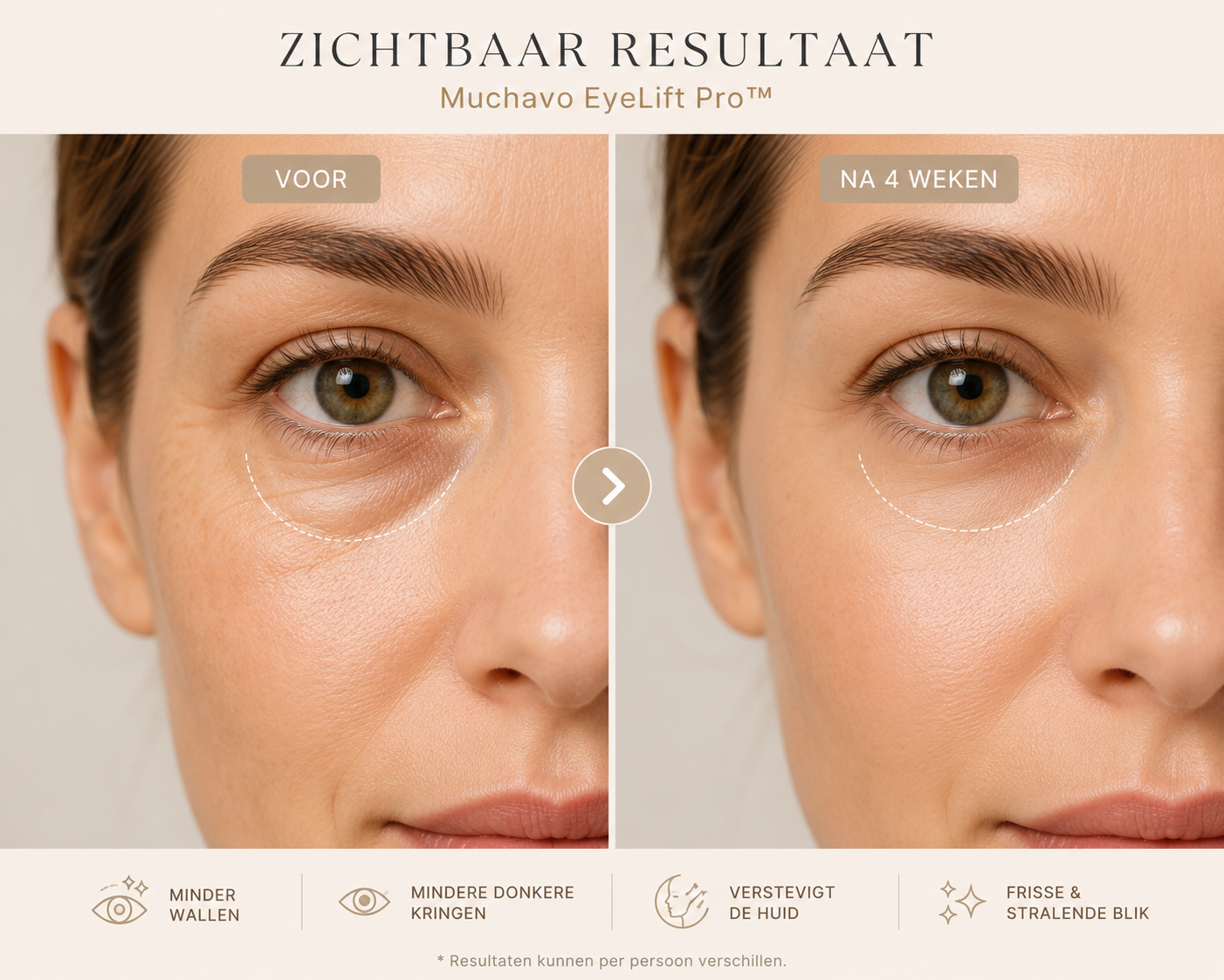 Muchavo EyeLift Pro™ – Luxe Ooglift Massager | Voor Ogen, Gezicht & Hals