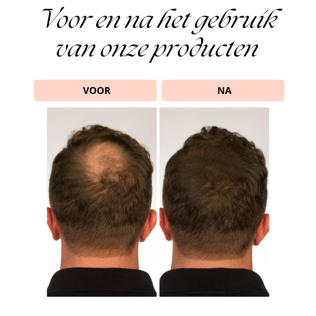HairRevive™ Volle Haar Booster